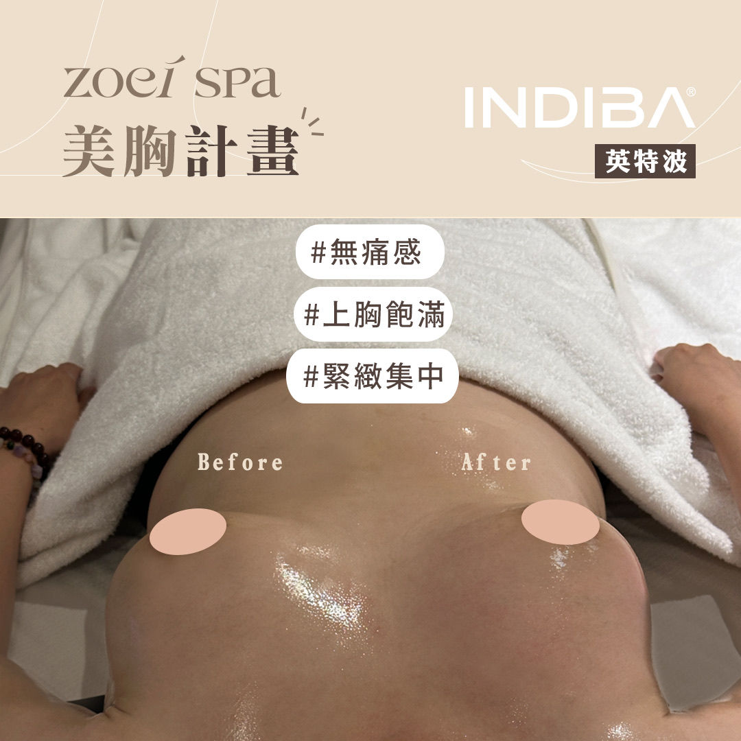 INDIBA 英特波 — 美胸上胸飽滿集中