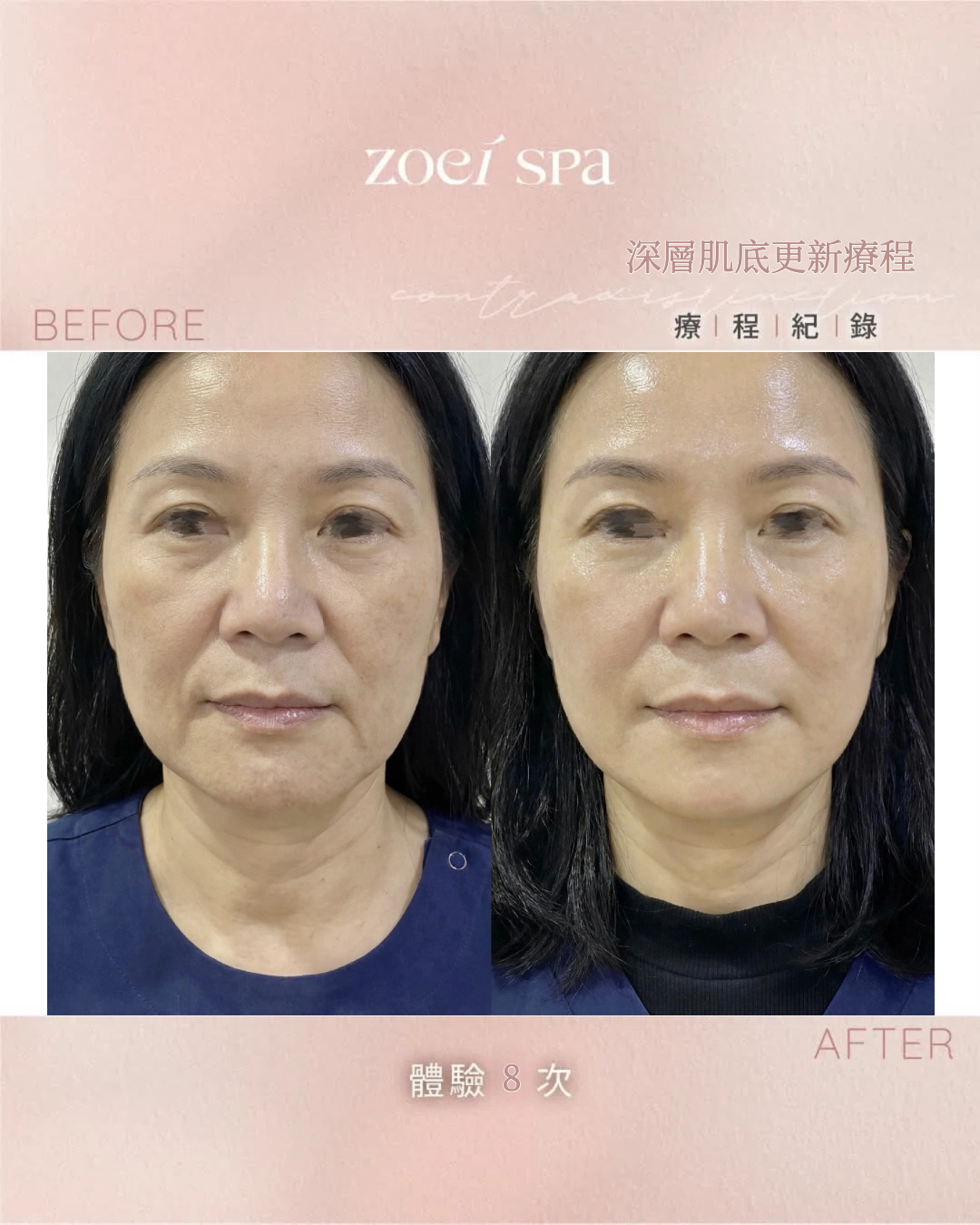 深層肌底更新 — 第 8 次：由內透出的光
