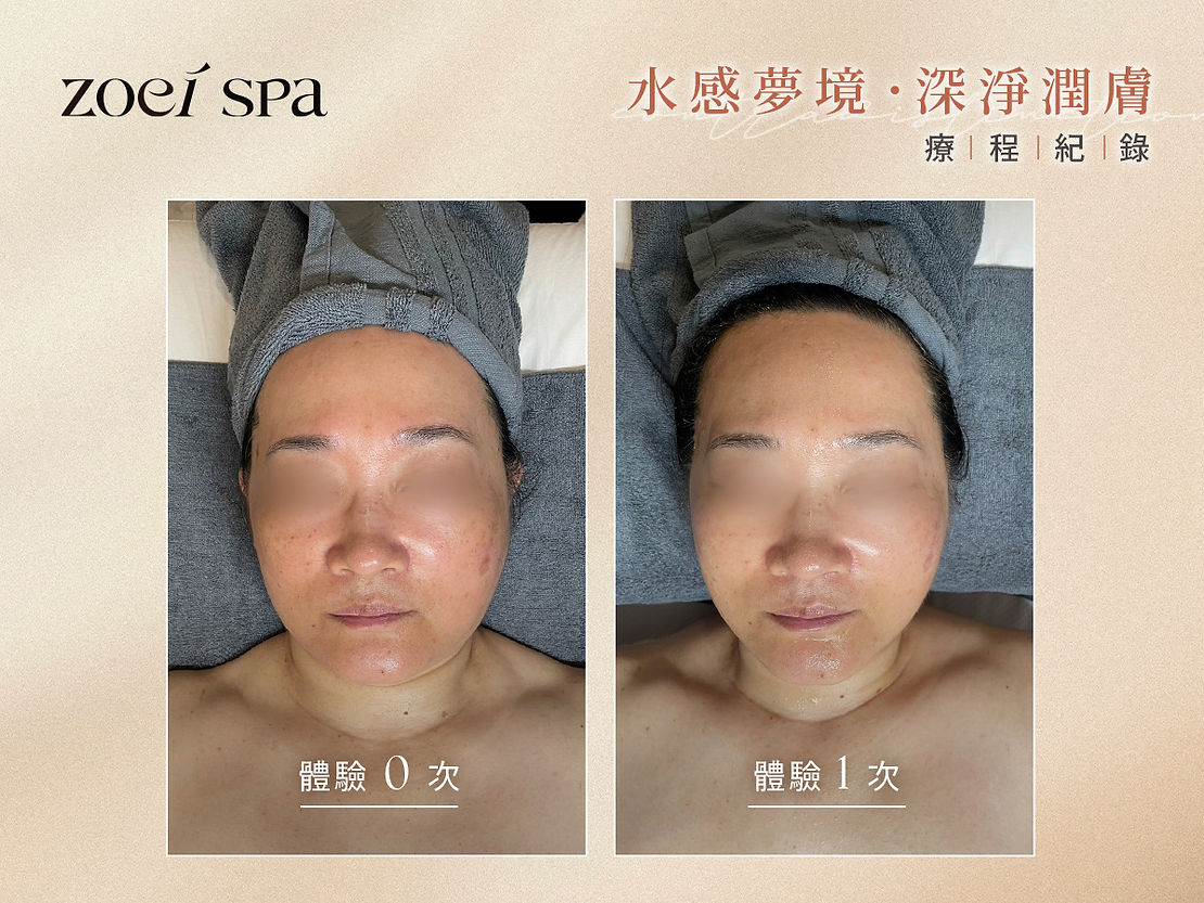 水感夢境療程 — 缺水暗沉一次喝飽水光
